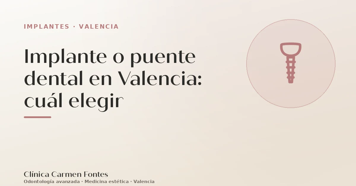 Implante o puente dental en Valencia: cuál elegir