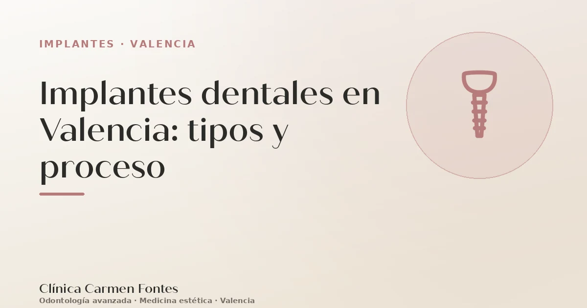 Implantes dentales en Valencia: tipos y proceso