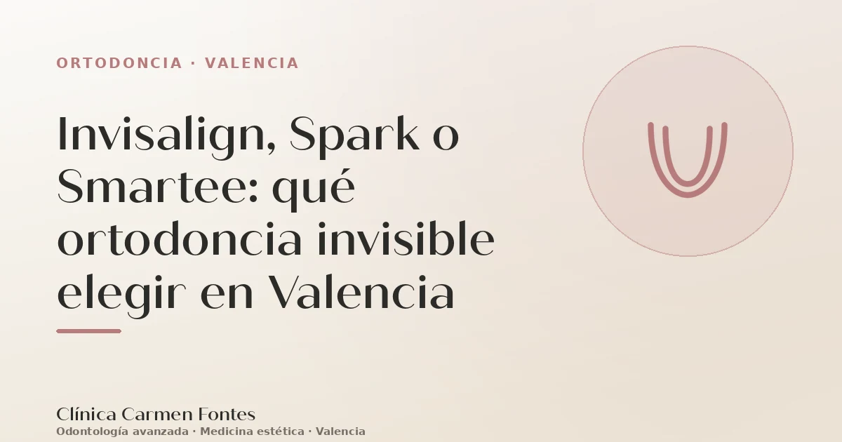 Invisalign, Spark o Smartee: qué ortodoncia invisible elegir en Valencia
