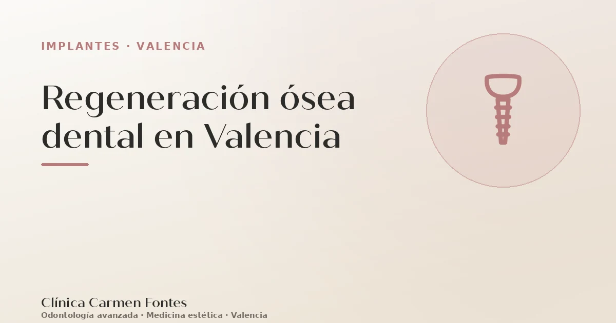 Regeneración ósea dental en Valencia