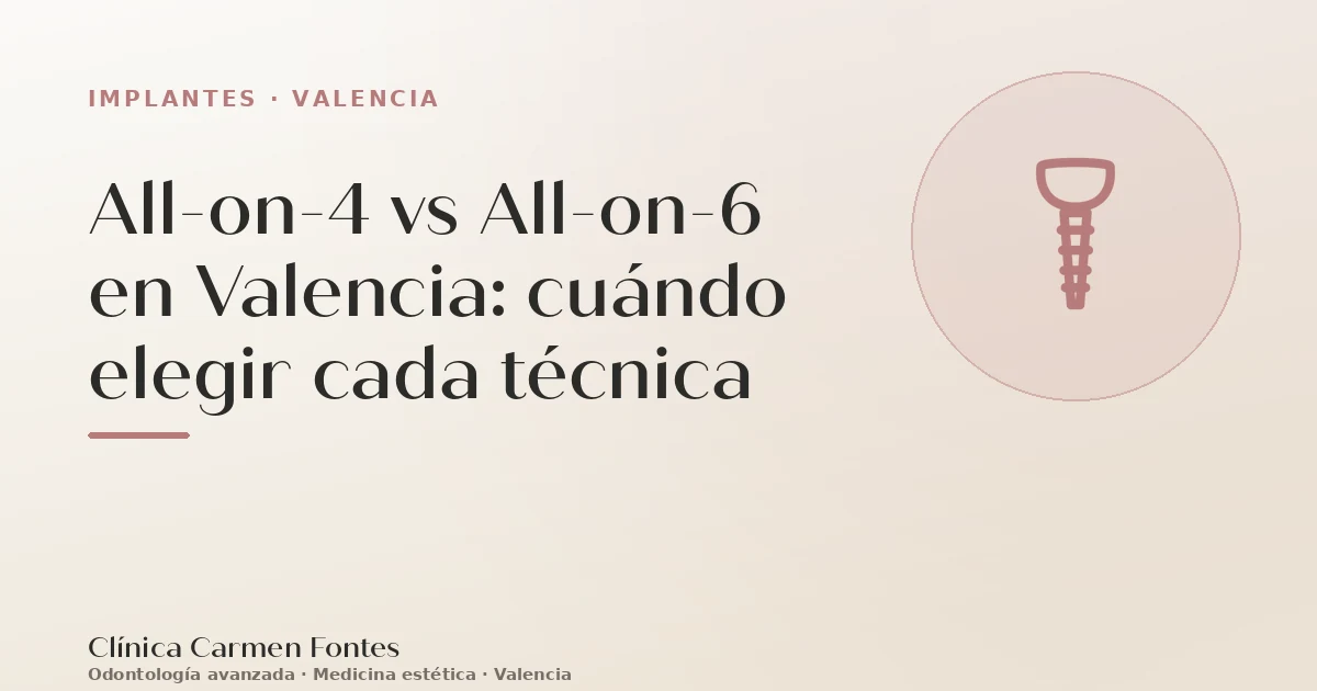 All-on-4 vs All-on-6 en Valencia: cuándo elegir cada técnica