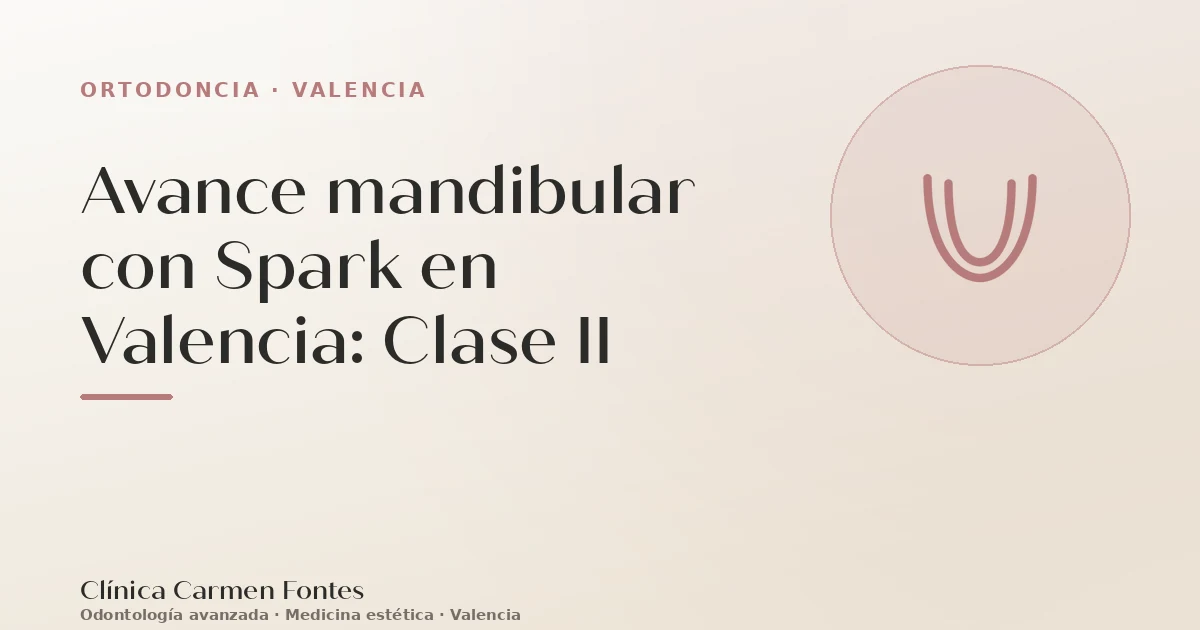 Avance mandibular con Spark en Valencia: Clase II