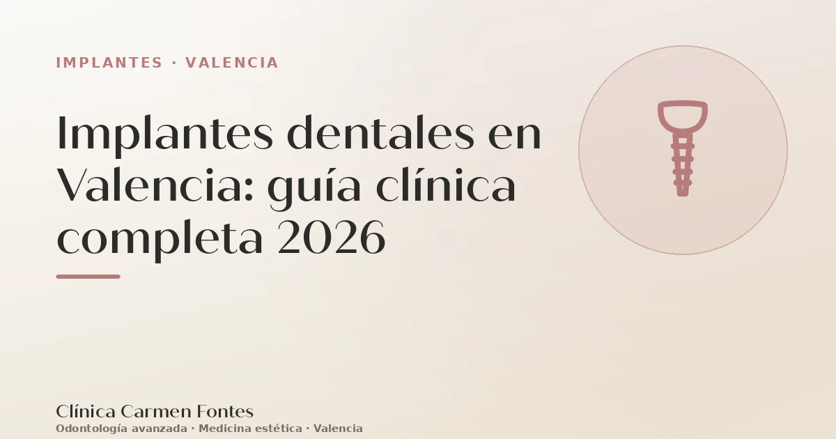 Implantes dentales en Valencia: guía clínica completa 2026