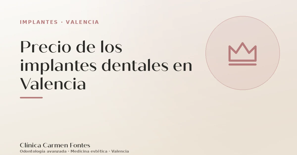 Precio de los implantes dentales en Valencia
